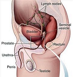 Prostate infection affects millions of men in the United States