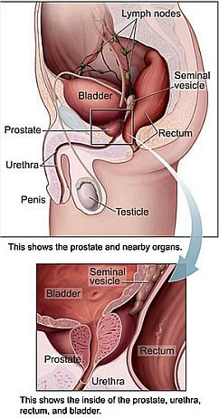 Prostate Infection. Prostate gland near the bottom of the bladder, close to the urethra.